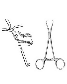 Oral Maxillo-Facial Surgery